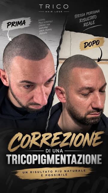Non tutti i trattamenti di tricopigmentazione nascono uguali. ❌⚠️

Quante volte ti è capitato di ved