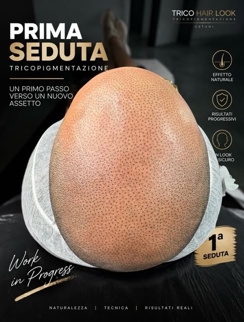 PRIMA SEDUTA. IL RISULTATO FINALE ARRIVA DOPO. 👇

Questa è una fase importante del trattamento di t