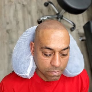10 years younger with Scalp Micropigmentation
.
FREE CONSULTATION
.
#hairtattoo #hairlosstreatment #