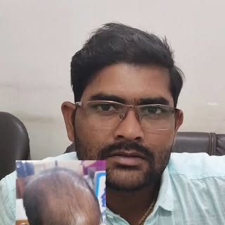 Hair Transplant Result 
Call on 8178330800
For more information 
Like and follow us 

#hairtransform