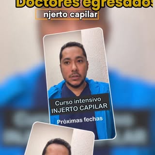 Otro testimonio de nuestros médicos regresados del curso de injerto capilar.