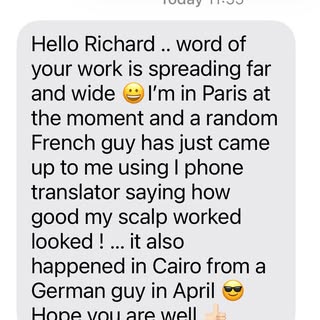 ⭐️⭐️⭐️⭐️⭐️
My clients getting compliments from around the world

Scalp Micropigmentation (SMP) can g