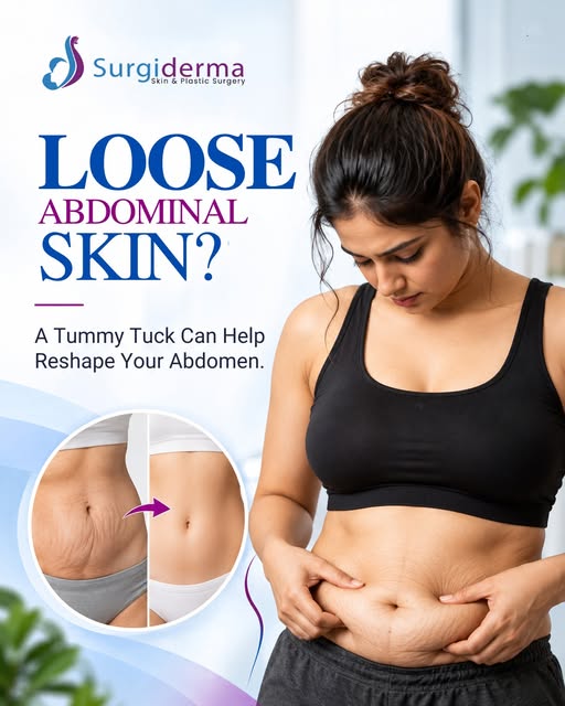 Struggling with loose or sagging abdominal skin that diet and exercise just won't fix? You're not al