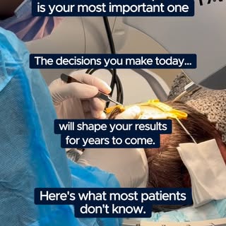 Your first hair transplant is your most important one.

Why?

Because every decision made during you