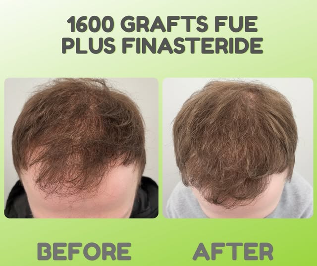 At Limmer HTC, we strive to ensure all our patients have the best results in their treatments. 
This