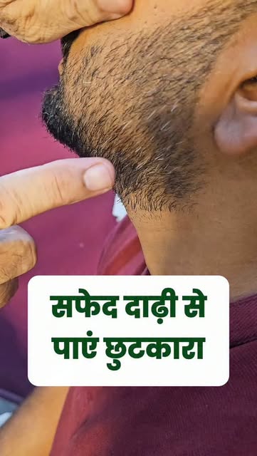 सफेद दाढ़ी से पाएं छुटकारा #whitebeard #whitebeardproblem #WhiteBeardTreatment