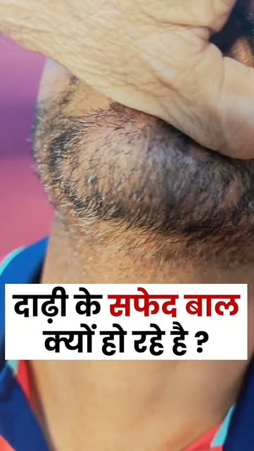 दाढ़ी के बाल सफेद क्यों होते हैं? #whitebeard #whitebeardtreatment #causesofwhitehair