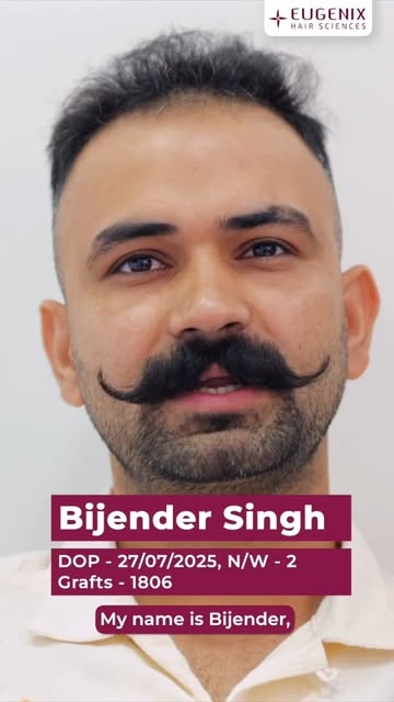 Sometimes, it’s not just the hair loss.
It’s everything that comes with it.

For Bijendra, losing hi