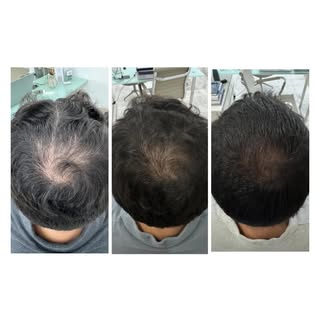 5 meses de tratamento clínico com esse resultado!!!