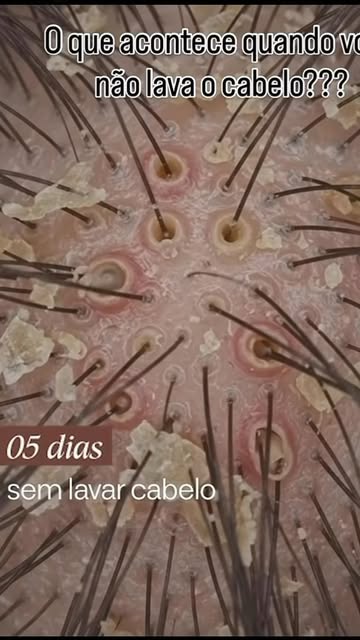 5 dias sem lavar o cabelo… e o couro cabeludo entrega tudo. 

O que parece apenas “cabelo sujo” vai 