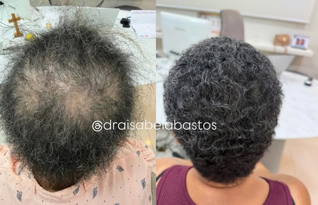 Ela não precisava de mais um tratamento. Precisava do diagnóstico certo. 

Quando essa paciente cheg