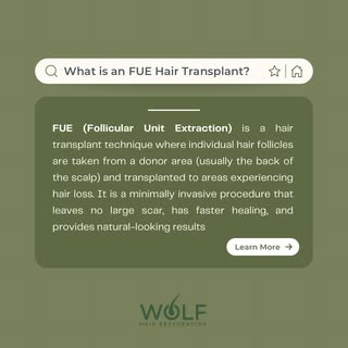 Thinking about a hair transplant? Here’s what you need to know 👇

FUE (Follicular Unit Extraction) 