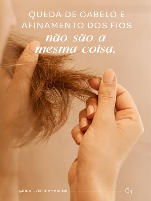 Nem sempre o principal sinal de uma alopecia é encontrar vários fios caídos.

Muitas vezes, o que ch