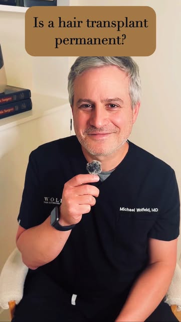 Is a hair transplant permanent? Q&A with Doctor Wolfeld. #hairlosshelp #nychair #hairtransplantation