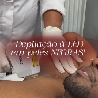 Depilação à LED em peles NEGRAS! ✊🏽✊🏾✊🏿

Essa é uma técnica que utiliza luz LED para remover pelo