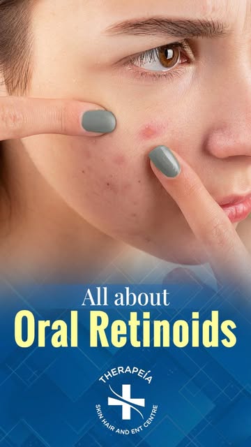 Want to know more about Isotretinoin?
Dr. Govind S Mittal highlights that oral retinoids are a game-