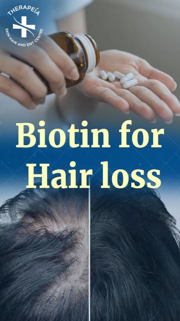 Is biotin really the key to solving hair loss? Dr. Govind S Mittal, an experienced dermatologist, ex