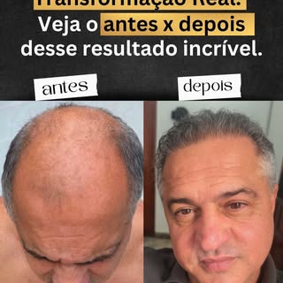 Transformação que fala por si!
Na Doctor Hair, cada resultado carrega uma história de confiança, cor