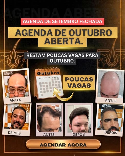 ### Agenda de setembro esgotada! 🚨

Setembro já está com a agenda **completamente preenchida** para