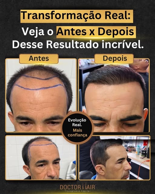 Transformação que fala por si!
Na Doctor Hair, cada resultado carrega uma história de confiança, cor
