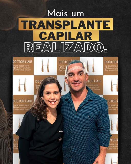 Mais um transplante capilar realizado com sucesso na Doctor Hair!
⠀
Cada detalhe foi cuidadosamente 