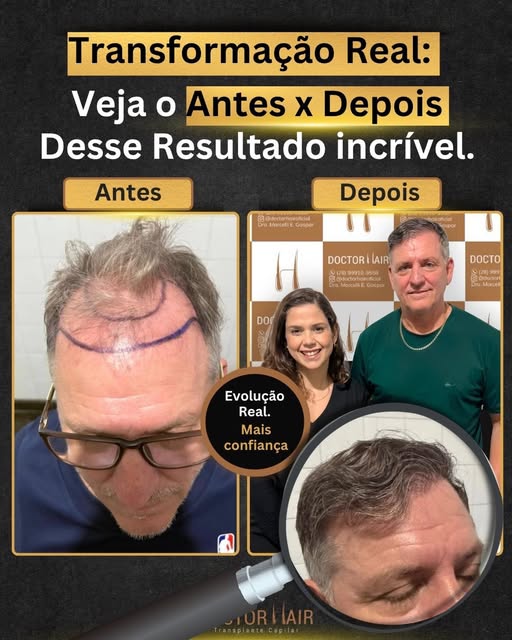 Transformação que fala por si!
Na Doctor Hair, cada resultado carrega uma história de confiança, cor