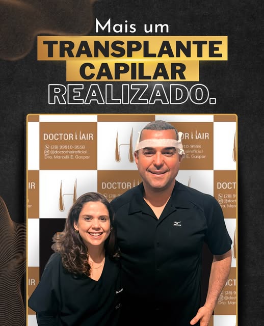 Mais um transplante capilar realizado com sucesso na Doctor Hair!
⠀
Cada detalhe foi cuidadosamente 