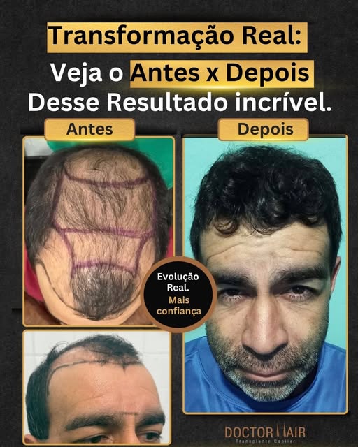 Transformação que fala por si!
Na Doctor Hair, cada resultado carrega uma história de confiança, cor