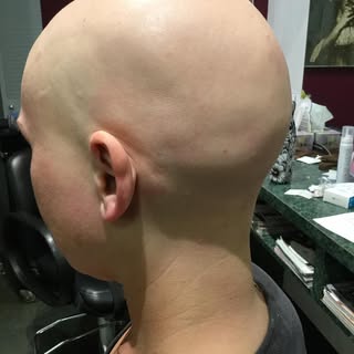You are not alone. Meet my beautiful client who has alopecia universalis and has been living with it