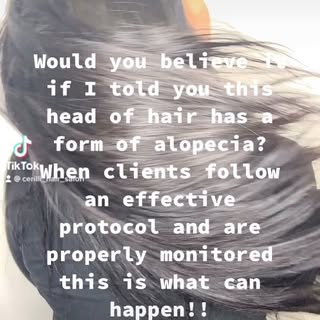 I have been a stylist for over 30 years but my work as a trichologist is something that raises my sk