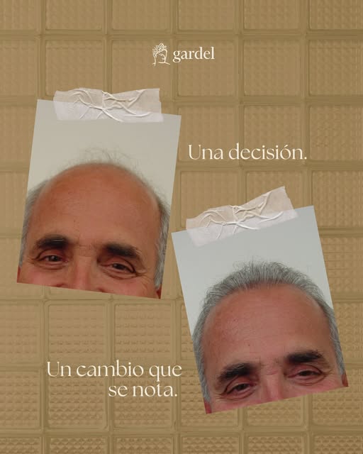 Una decisión que puede transformar mucho más que tu imagen. ✨
Cada caso tiene su propio punto de par