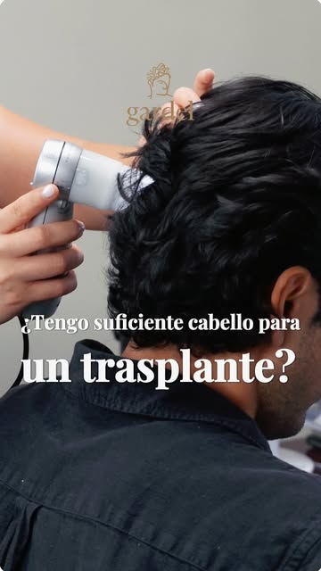 ¿Crees que ya tienes muy poco cabello para un trasplante?
No todos los casos necesitan la misma solu
