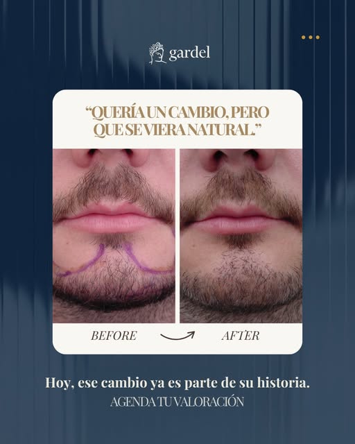 Cada procedimiento comienza con una valoración y una planeación personalizada, cuidando cada detalle