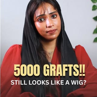 5000 grafts irundhaalum natural result guarantee illa.

Natural hairline-ku graft count vida,
**Dire