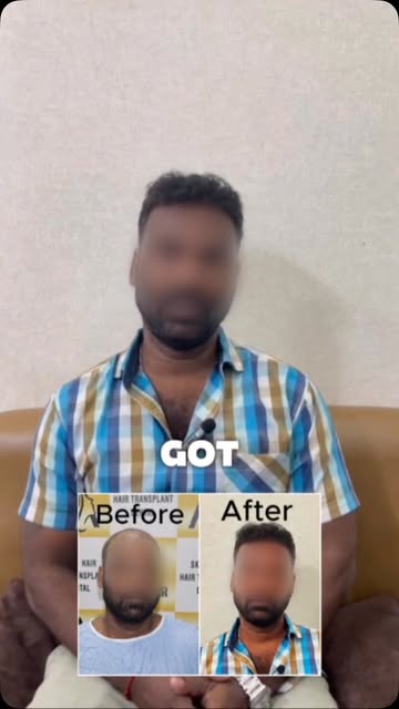 Can Hair Transplant really work?
Listen to this 👆🏼

To know what treatment needed to get best resu