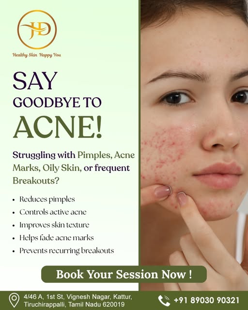 Struggling with pimples, acne marks, oily skin or frequent breakouts? ✨
Clearer, healthier-looking s