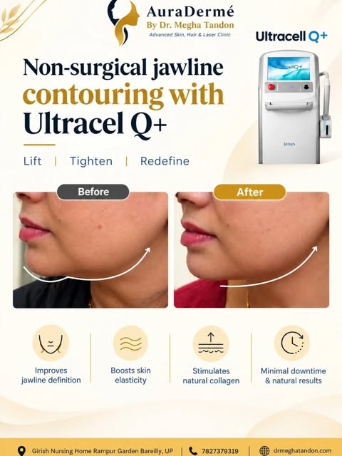 Lift, tighten, and redefine your jawline—no surgery required! ✨

​Swipe to see the visible lift achi