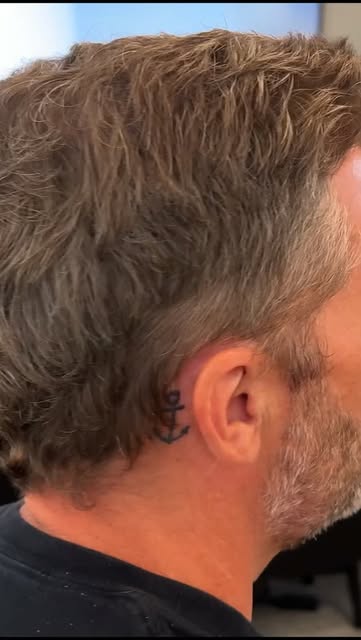 Check out how seamlessly Jon’s natural crown swirl reformed 12 months after his Multi-Unit Hair Graf