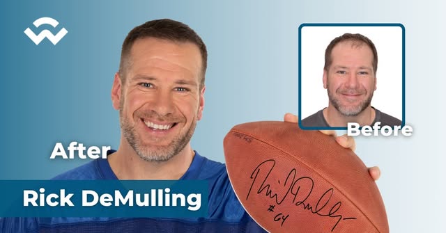 Former Colts offensive lineman Rick DeMulling spent years hiding his thinning hair under hats after 
