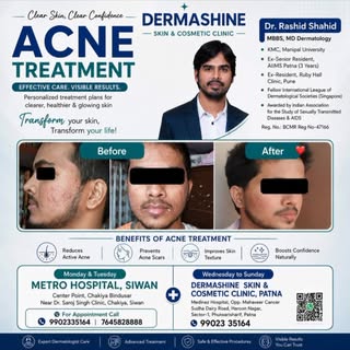 For acne treatment, consult Dr. Rashid Shahid, MBBS, MD Dermatology, Dermashine Skin & Cosmetic Clin
