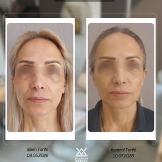 Aynaya baktığınızda kendinizi daha dinlenmiş görmek, doğru planlanmış  kişiye özel uygulamalarla müm