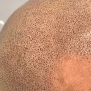 La qualité avant tout!

RÉSULTAT APRÈS 1 ANS, avec une modification de la forme des tempes.
TOUJOURS