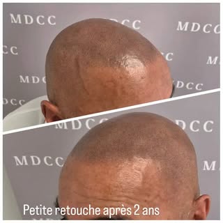 Vous pouvez effectuer votre retouche en été comme en hiver!
La séance de rafraichissement va réhauss
