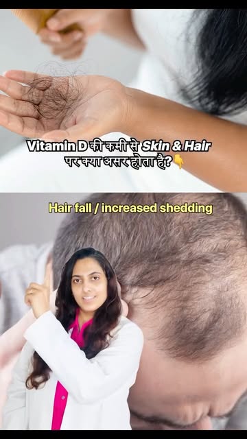 Vitamin D deficiency can affect more than just your bones. ☀️ It may also influence your skin and ha