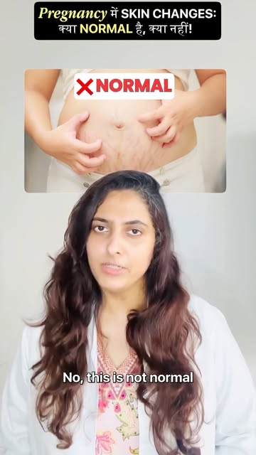 Pregnancy can change your skin in so many ways — pigmentation, acne, sensitivity or itching. 🤰🏻

B