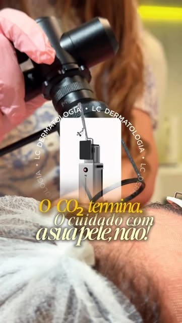 E o pós-CO₂ ? Busco acompanhar as necessidades de cada pele, porque cada paciente pode apresentar um