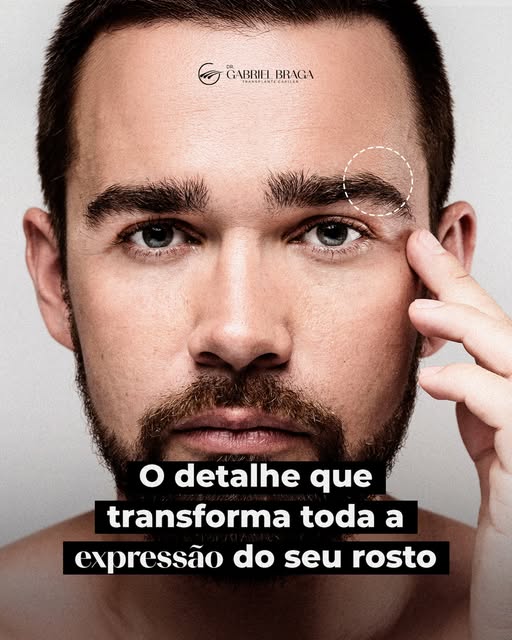 As sobrancelhas têm um papel fundamental na harmonia facial. Elas valorizam o olhar, equilibram as p