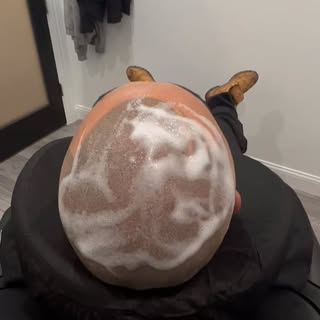 Full Treatment of Scalp Micropigmentation (SMP) completed 
 
Receive 20% off for full treatment for 