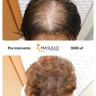 Scorri il carosello per scoprire il percorso e la trasformazione di questa nostra paziente, dopo 11 