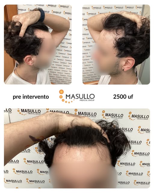 Scorri il carosello per scoprire il percorso e la trasformazione di questo nostro paziente, dopo 12 